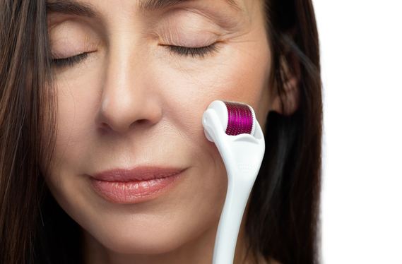 Frau, Microneedling